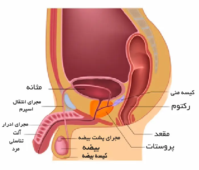 اناتومی بدن فرد دارای سرطان پروستات 231564655210