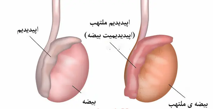 تفاوت بیضه سرطانی و بیضه سالم 654564610