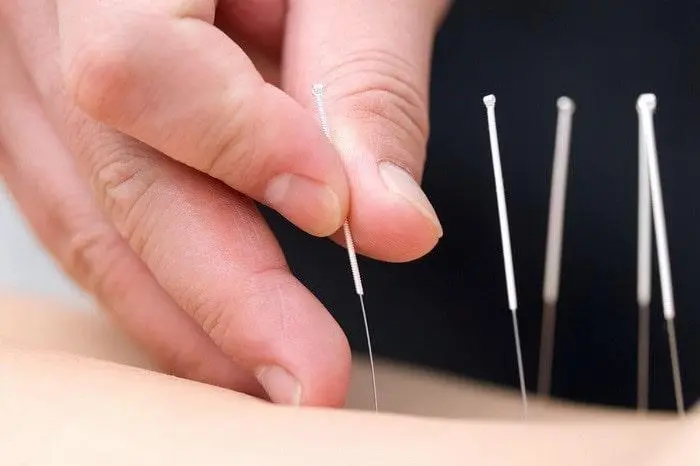 تکنیک های طب سنتی در بهبود درمان سرطان 5654655