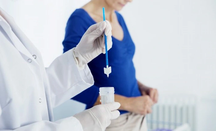 نمونه برداری از دهانه رحم 14654561