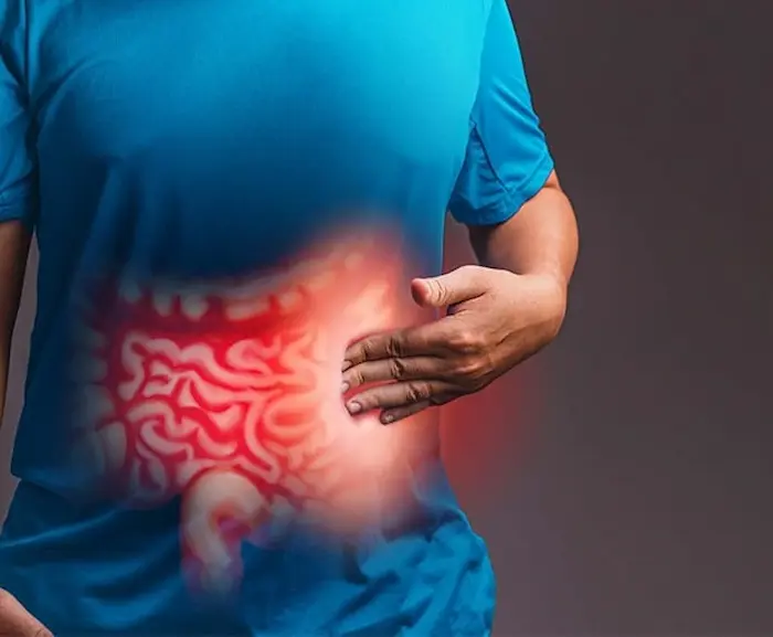 دیده شدن سرطان روده در قسمت پهلو ها وکمر 875342236