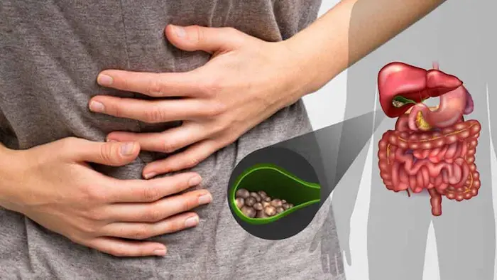 درد شدید شکم به دلیل سرطان کیسه صفرا 546546341