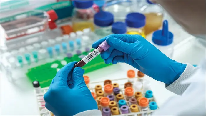 آزمایش ریه 7654333در آزمایشگاه