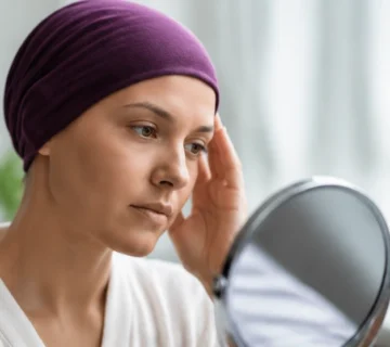ریزش مو بعد از شیمی درمانی