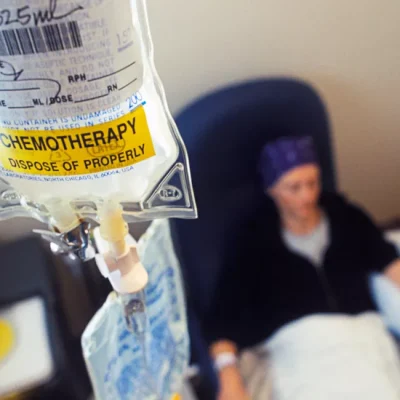 انجام دادن شیمی درمانی 453443433