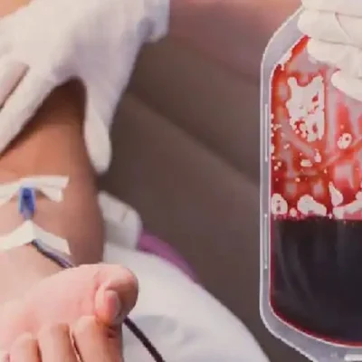 تزریق خون در شیمی درمانی 3645640.