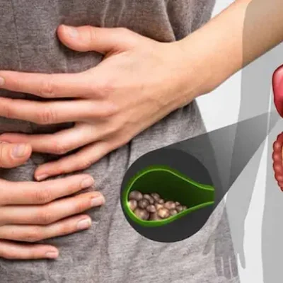 درد شدید شکم به دلیل سرطان کیسه صفرا 546546341