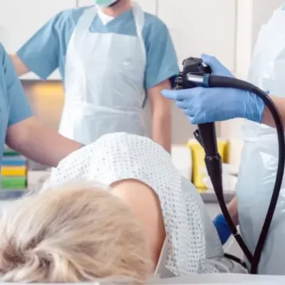 انجام کولونوسکوپی برای تشخیص سرطان روده بزرگ 78789776